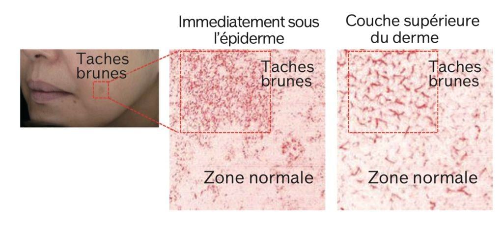 Lifeblood Research: a correlação entre a microcirculação e o envelhecimento da pele está comprovada 1 captura 21- Aconselhamento especializado - Informações sobre o produto