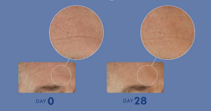 site-industries-cosmetiques A man's face is shown before and after a Brouillon auto care treatment.