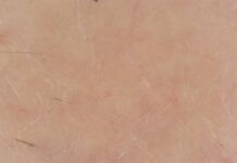 site-industries-cosmetiques Image en gros plan d'une peau humaine avec des ridules visibles, des pores et quelques poils épars. Le teint de la peau est clair, avec de légères rougeurs et une texture naturelle ressemblant à un effet brouillon auto.