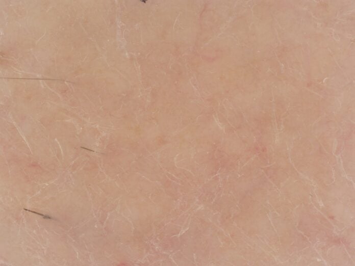 site-industries-cosmetiques Image en gros plan d'une peau humaine avec des ridules visibles, des pores et quelques poils épars. Le teint de la peau est clair, avec de légères rougeurs et une texture naturelle ressemblant à un effet brouillon auto.