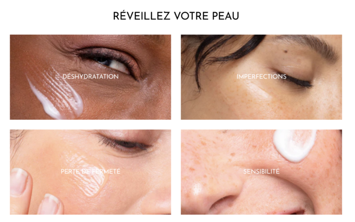 site-industries-cosmetiques Uma colagem de quatro imagens em grande plano de rostos aos quais foi aplicado um creme de cuidados da pele, cada uma delas rotulada de acordo com um problema de pele francês: desidratação, imperfeições, perda de firmeza e sensibilidade. O texto no topo diz 