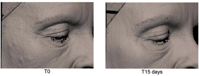 site-industries-cosmetiques Side-by-side close-up images of a person's closed eye and surrounding skin, labeled 
