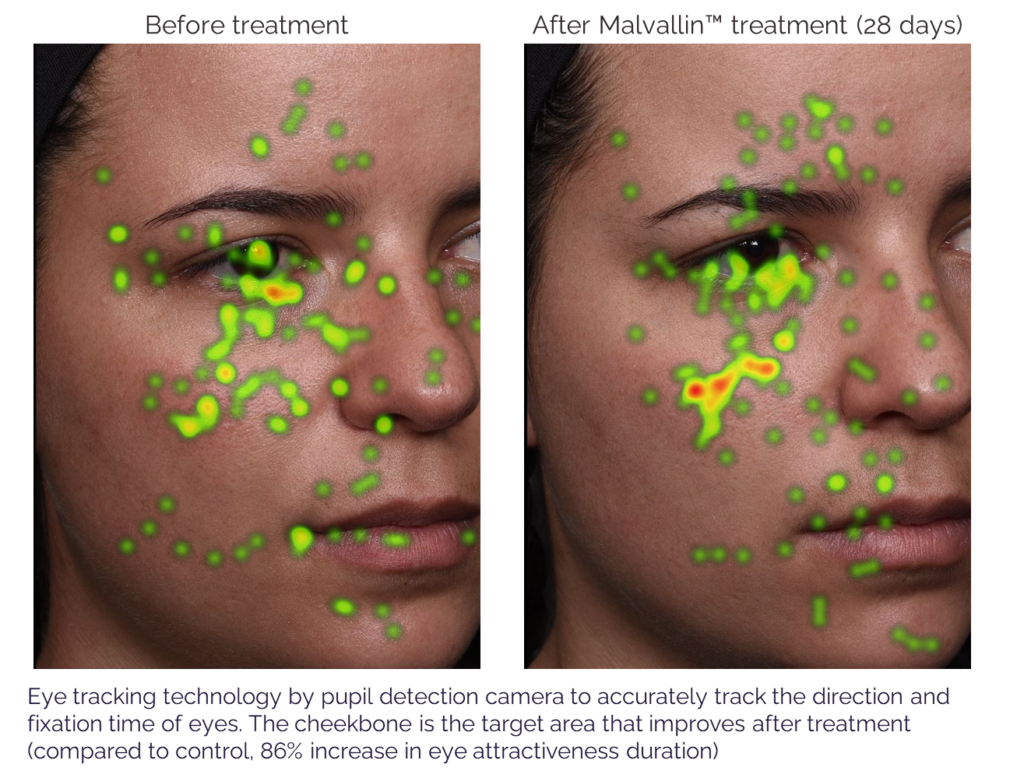 site-industries-cosmetiques Side-by-side images of a woman's face show green and yellow dots on the heat map, indicating the focal points of eye tracking before and after 28 days of Malvallin treatment, with the increased intensity highlighting the expressive skin around the eyes and cheekbones.
