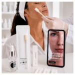 Compatibilidade pele-produto: Byome Derma, um kit de diagnóstico do microbioma para o retalho site-industries-cosmetiques Uma pessoa está a ter uma amostra de pele recolhida com um cotonete. Em primeiro plano, avistam-se produtos de cuidados da pele, um kit de amostras e um smartphone que exibe um grande plano da pele, bem como o texto: «Descubra a verdadeira natureza da sua pele.».